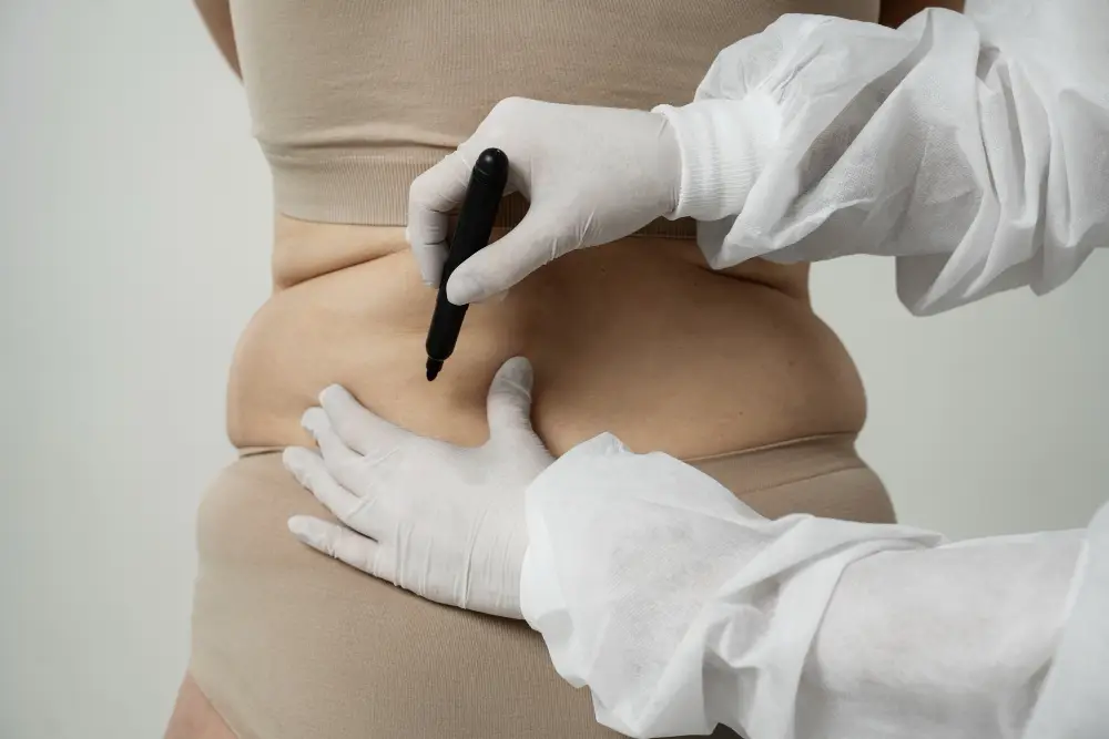 Localized Fat Removal